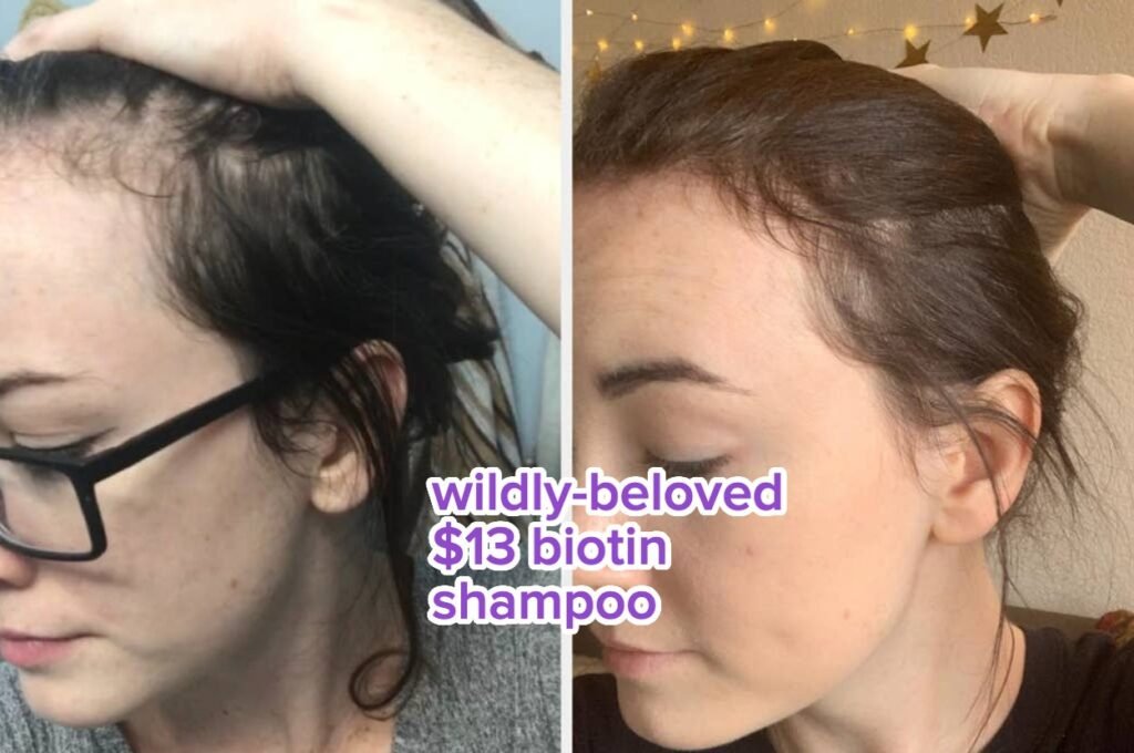 36 Beauty Products With Before And Afters So Good, You’ll Be Like, “Me Next”