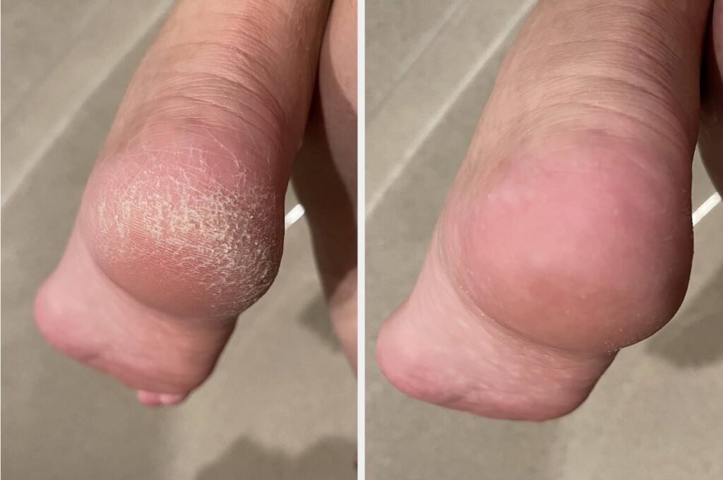 32 Products With Before-And-After Photos That’ll Inspire You To Get Your Life Together