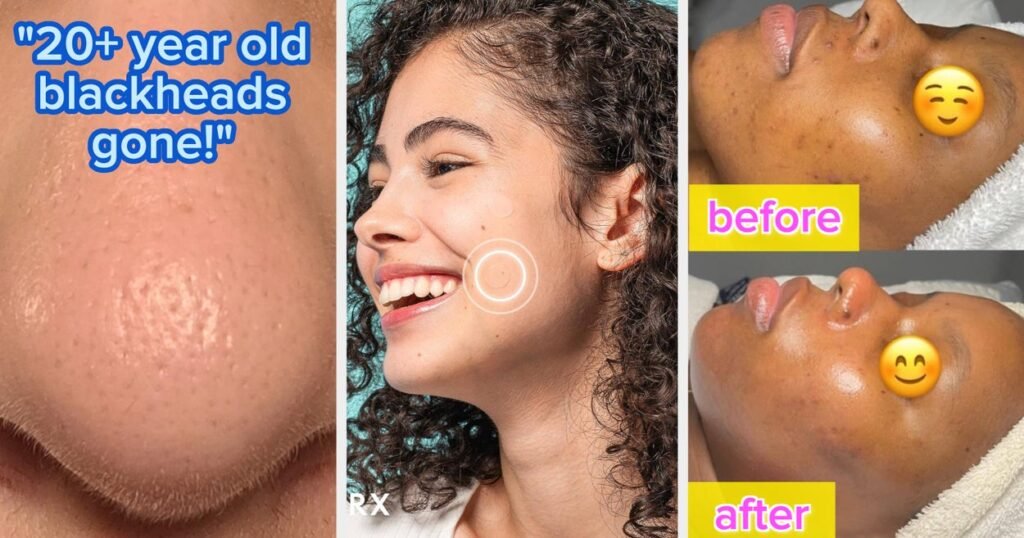 30 Korean Skincare Products For Common Skin Problems