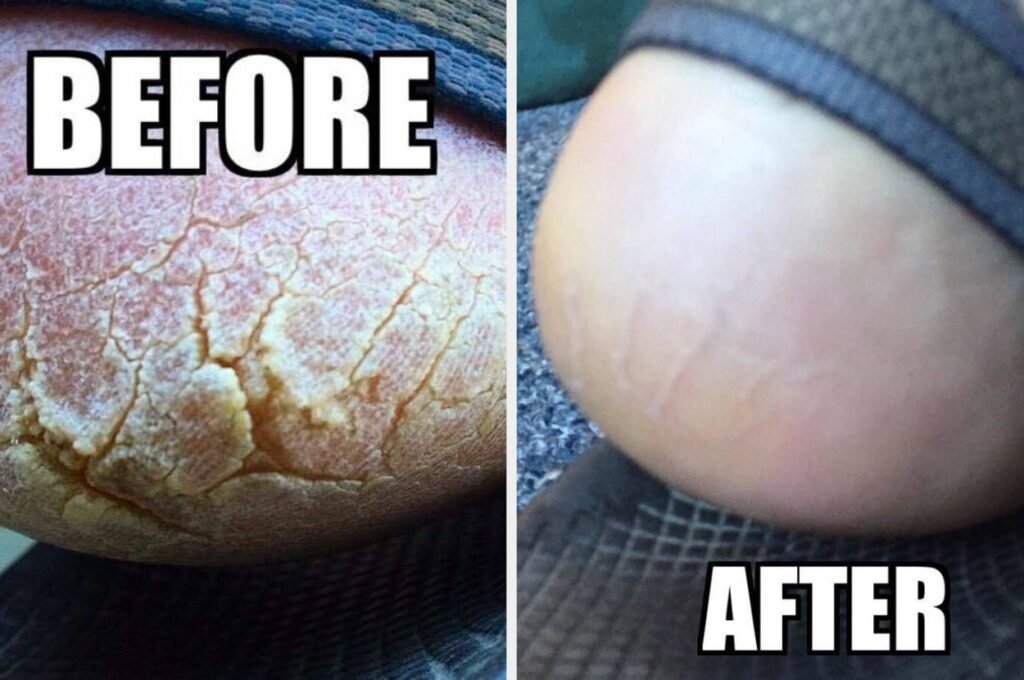 These 32 Products Work Scary Good, And We’ve Got The Reviewer Pics To Prove It